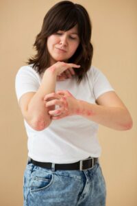 ansiedade-psoriase